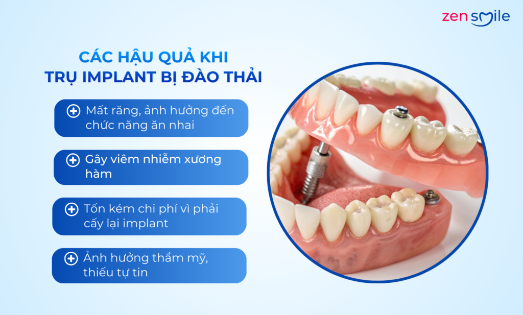 Lấy implant cũ — ảnh 5