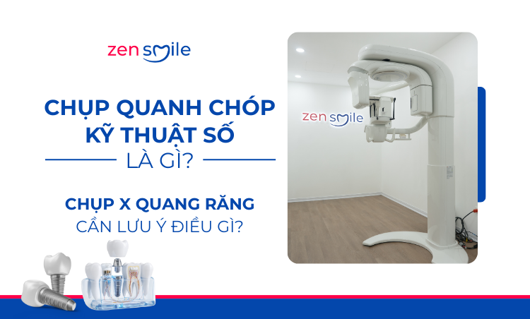 Chụp quanh chóp kỹ thuật số — ảnh 6