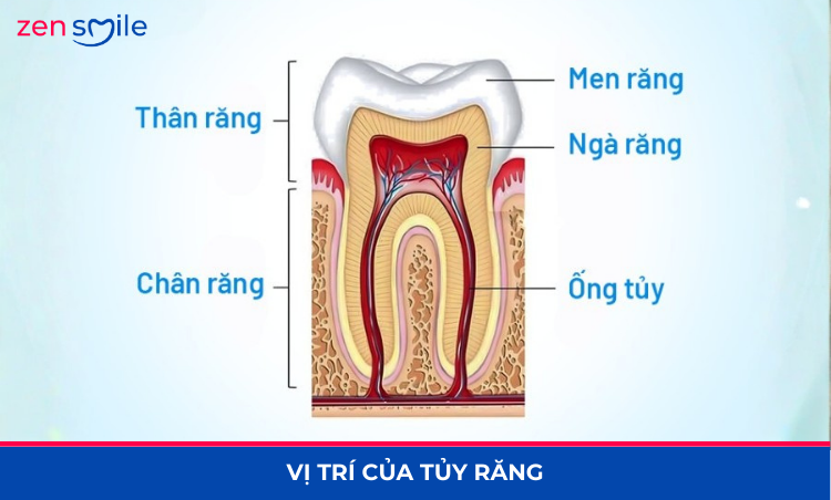 Điều trị tuỷ lại (răng đã từng điều trị tuỷ) — ảnh 2