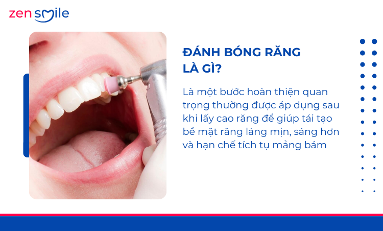 Đánh bóng răng — ảnh 6