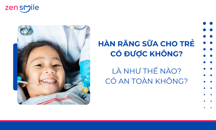 Hàn răng sữa em bé — ảnh 2