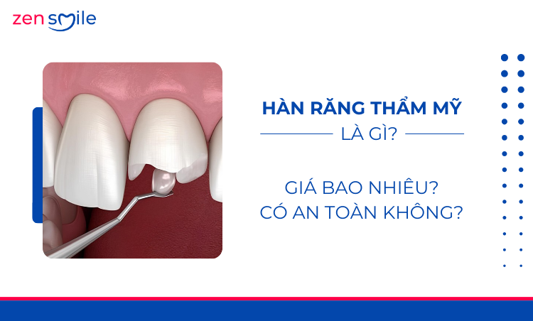 Hàn răng thẩm mỹ — ảnh 5