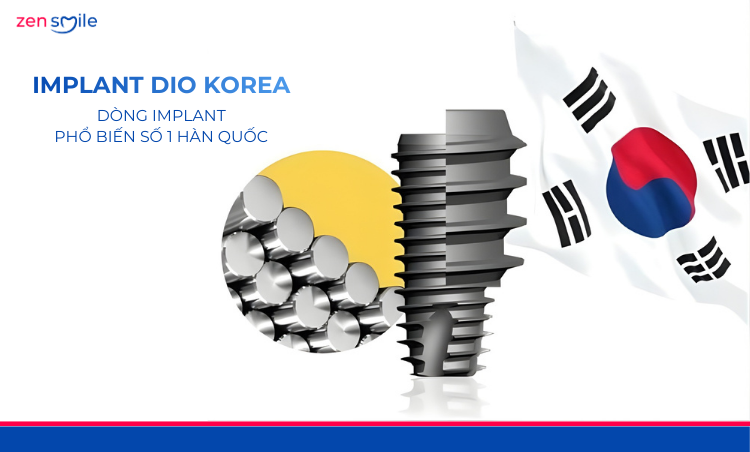 Implant All-on DIO Korea — ảnh 2