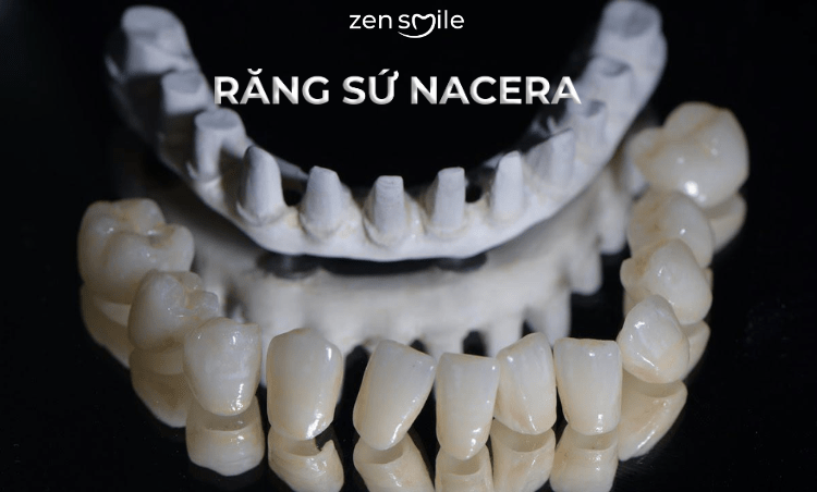 Răng sứ Nacera Q3 — ảnh 4