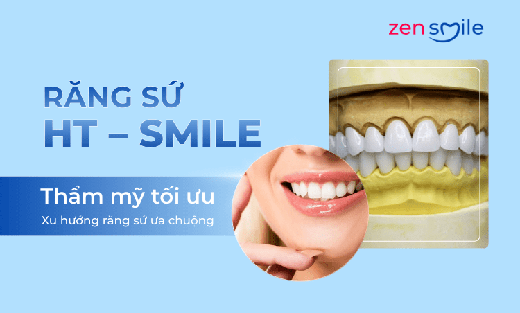 Răng sứ HT-Smile — ảnh 2
