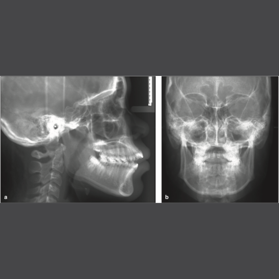 Chụp 2D Cephalometric — ảnh 1