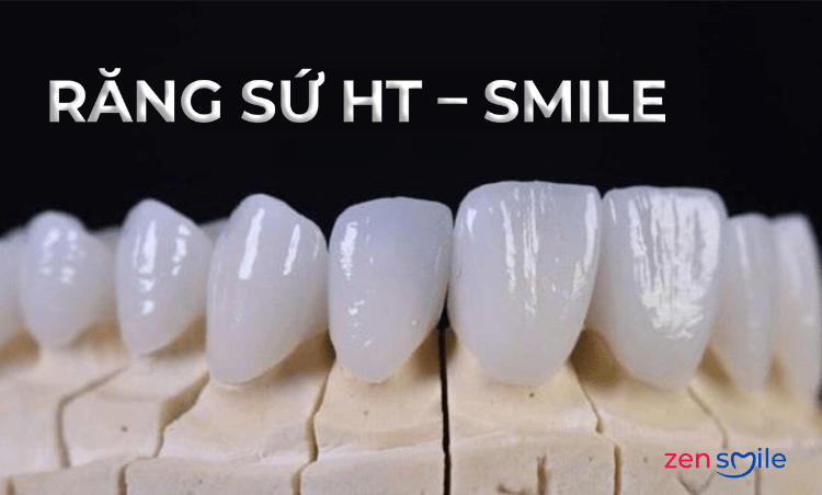 Răng sứ HT-Smile — ảnh 4