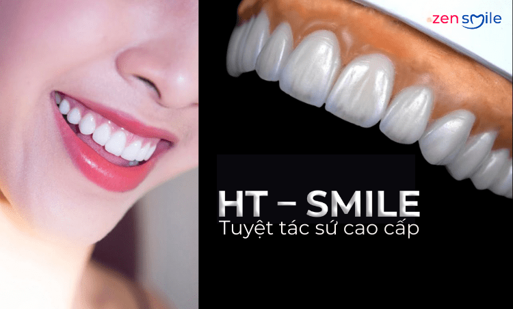 Răng sứ HT-Smile — ảnh 6