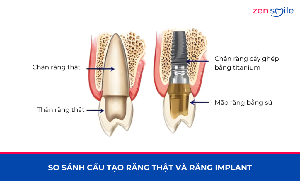 Cấy chuyển răng tự thân — ảnh 4