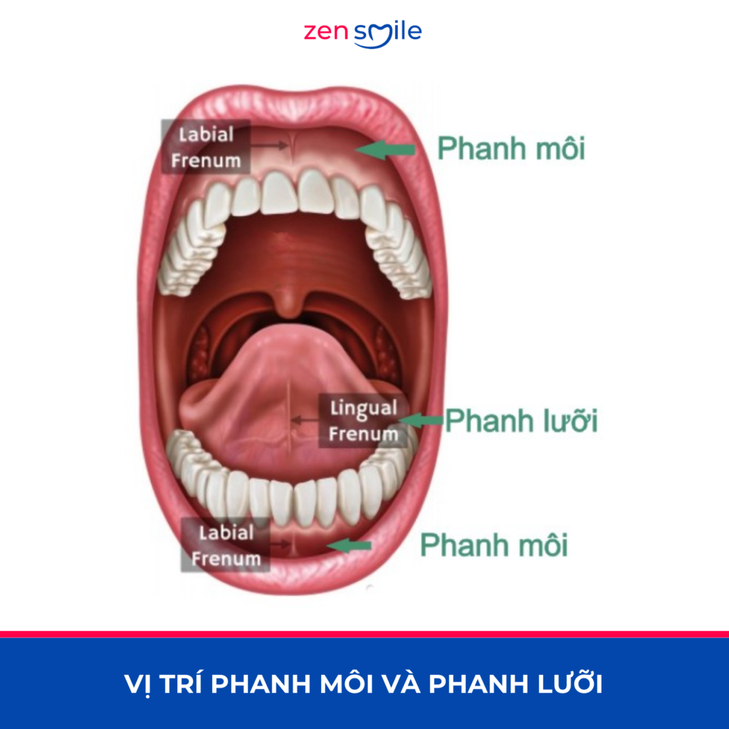 Cắt phanh môi, lưỡi — ảnh 6