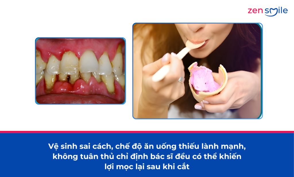 Cắt lợi sừng hoá — ảnh 5