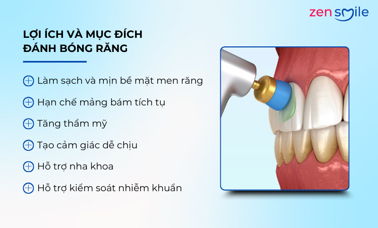 Đánh bóng răng — ảnh 7