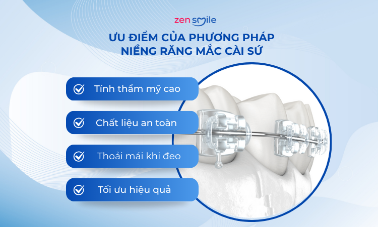 Mắc cài sứ truyền thống — ảnh 3