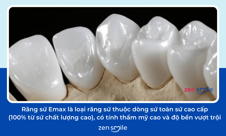 Răng sứ Emax — ảnh 3