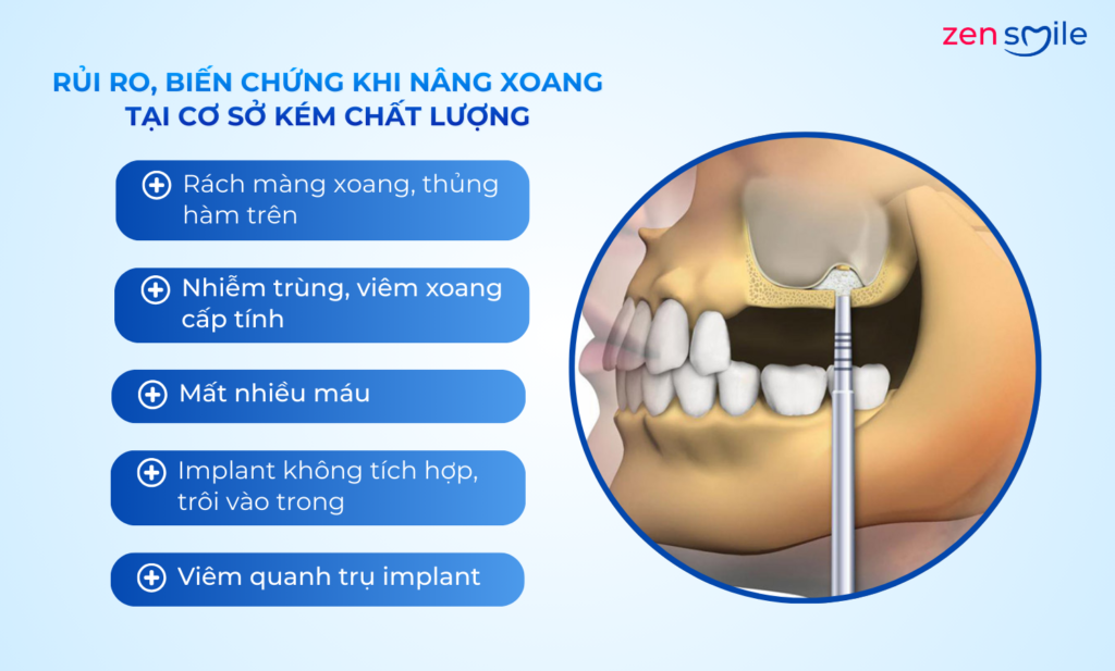 Nâng xoang — ảnh 7