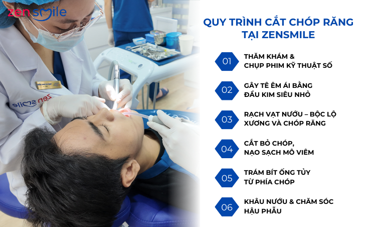 Phẫu thuật cắt chóp răng — ảnh 4
