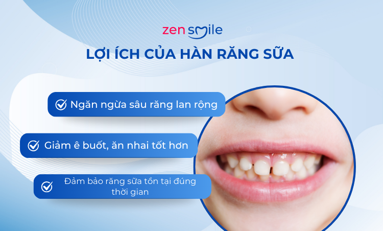 Hàn răng sữa em bé — ảnh 3