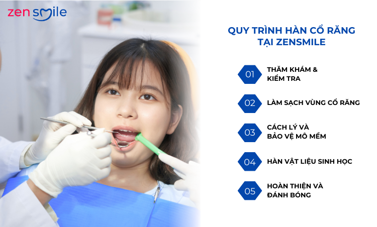 Hàn cổ răng — ảnh 4