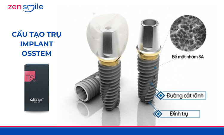 Implant All-on Osstem — ảnh 4