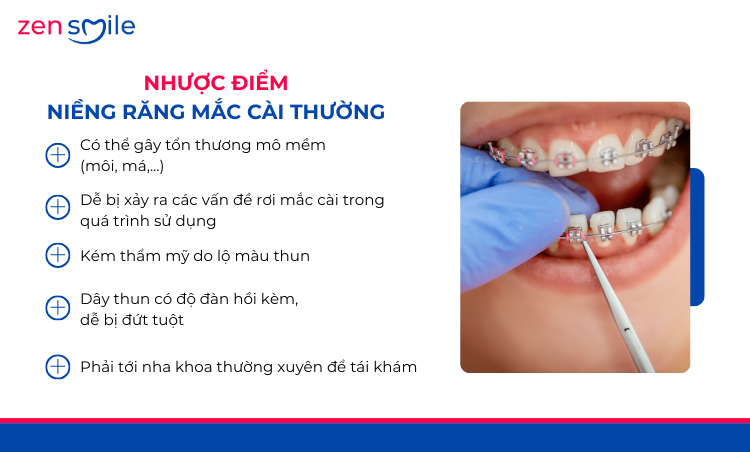 Mắc cài kim loại truyền thống — ảnh 7
