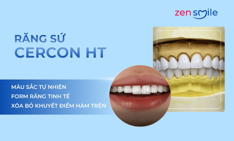 Răng sứ Cercon HT — ảnh 5