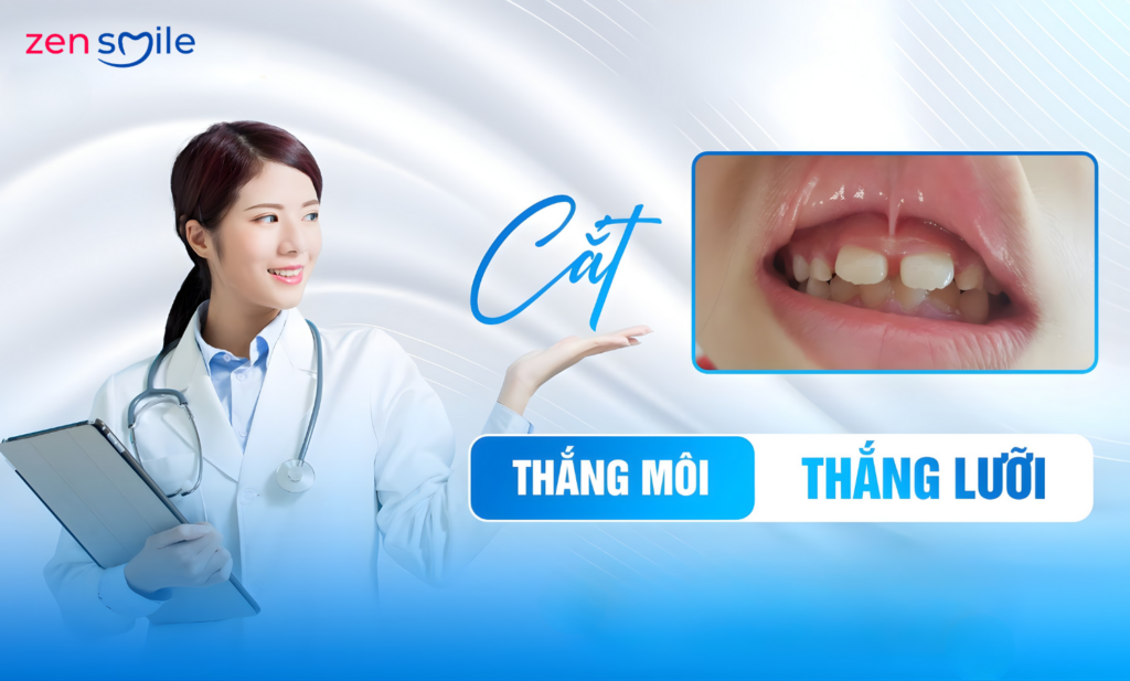 Cắt phanh môi, lưỡi — ảnh 2