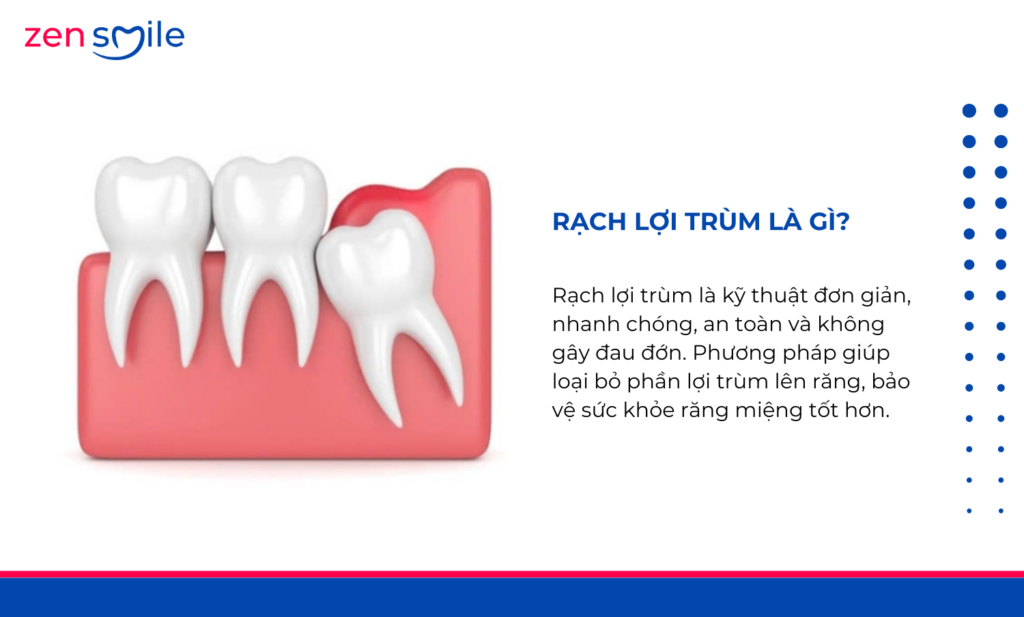 Rạch lợi trùm — ảnh 7