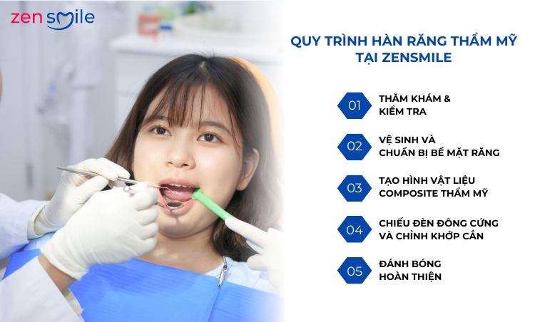 Hàn răng thẩm mỹ — ảnh 3