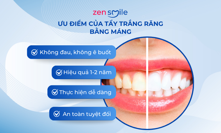 Tẩy trắng răng tại nhà — ảnh 3
