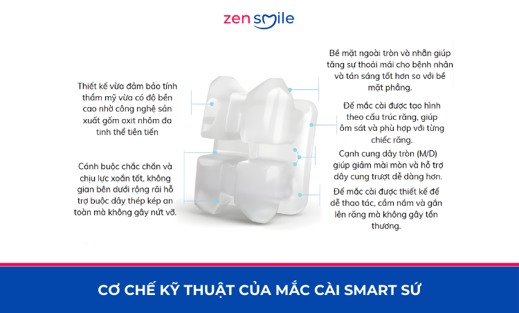 Mắc cài Smart sứ — ảnh 4