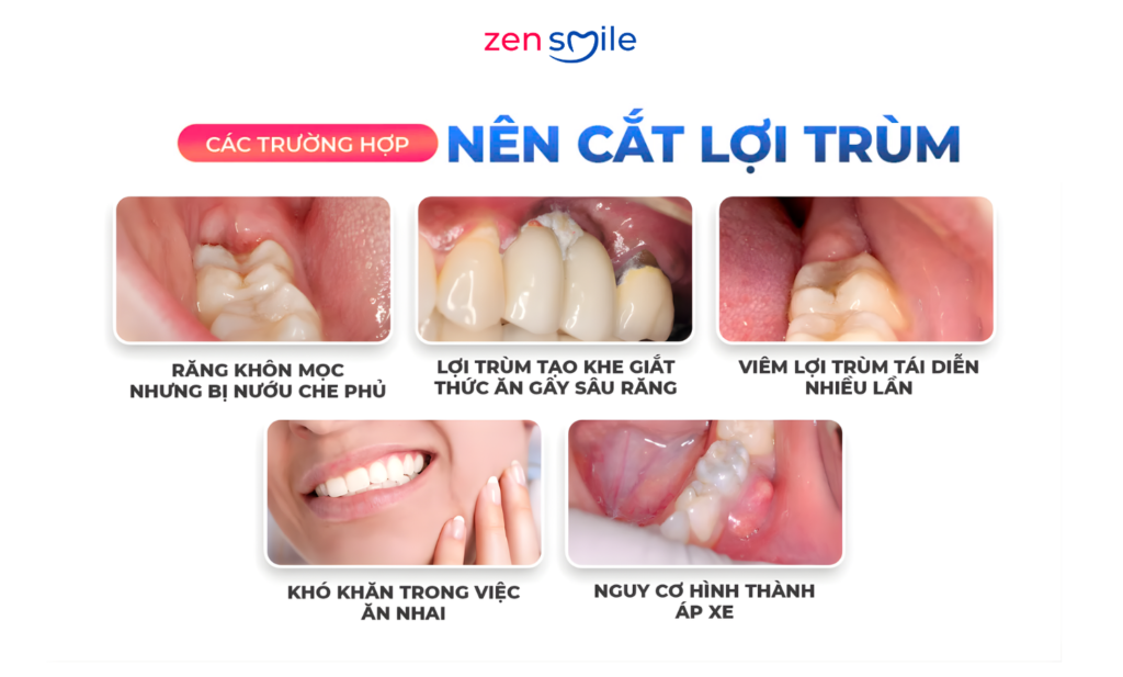 Rạch lợi trùm — ảnh 4