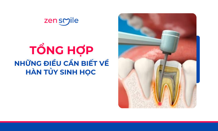 Hàn tuỷ bằng chất hàn sinh học — ảnh 7