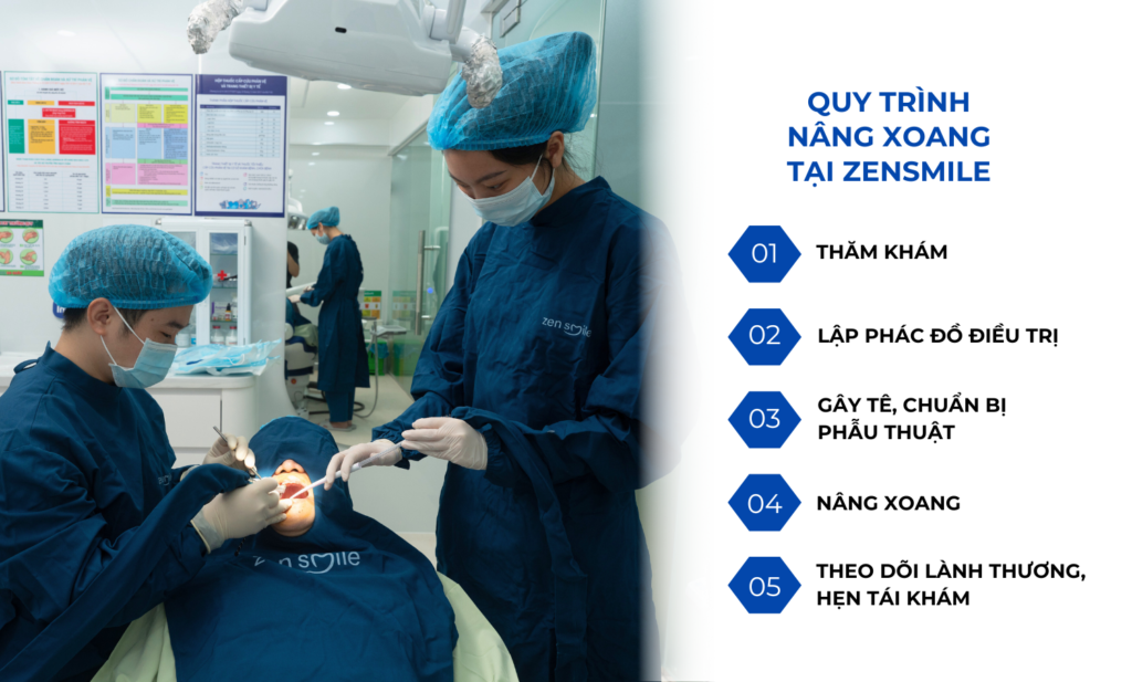 Nâng xoang — ảnh 5