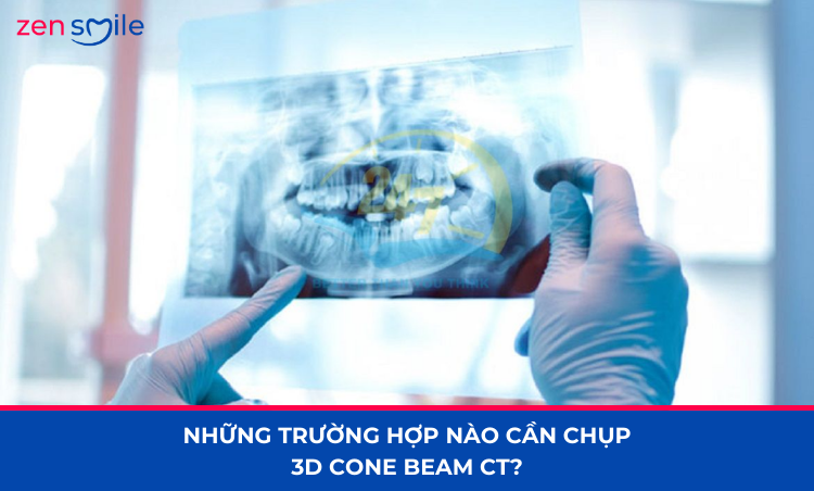 Chụp 3D Cone Beam CT — ảnh 6