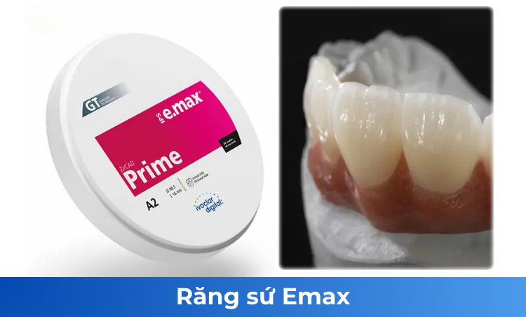 Răng sứ Emax — ảnh 2