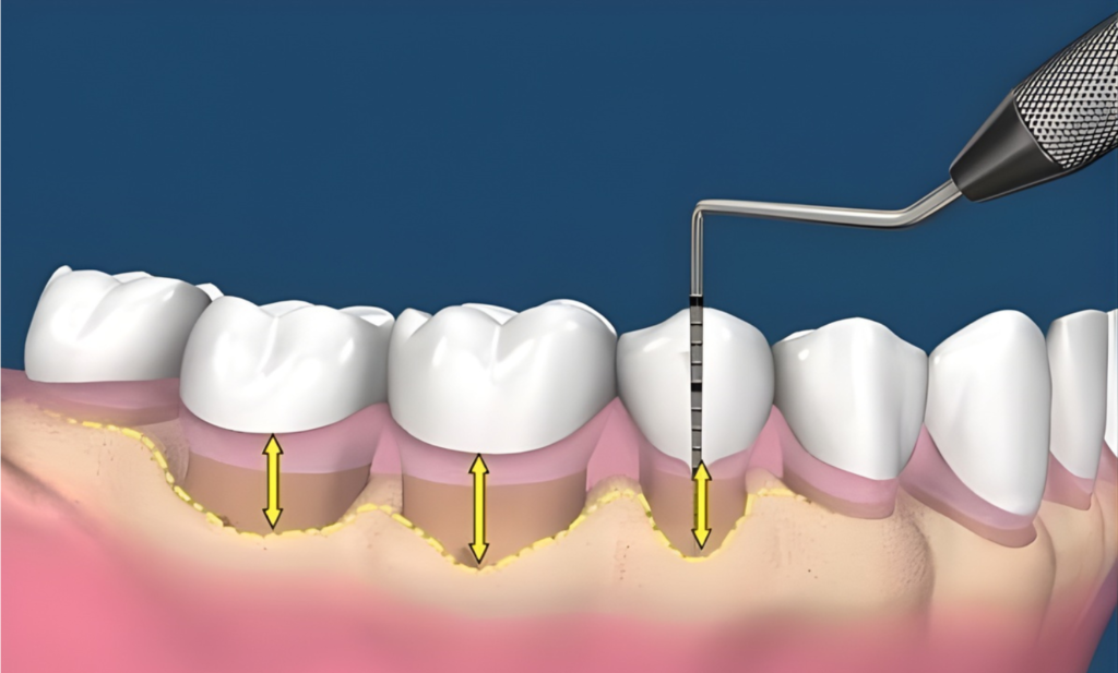 Ghép mô liên kết — ảnh 2