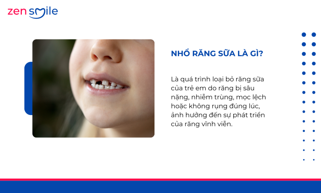 Nhổ răng em bé — ảnh 5