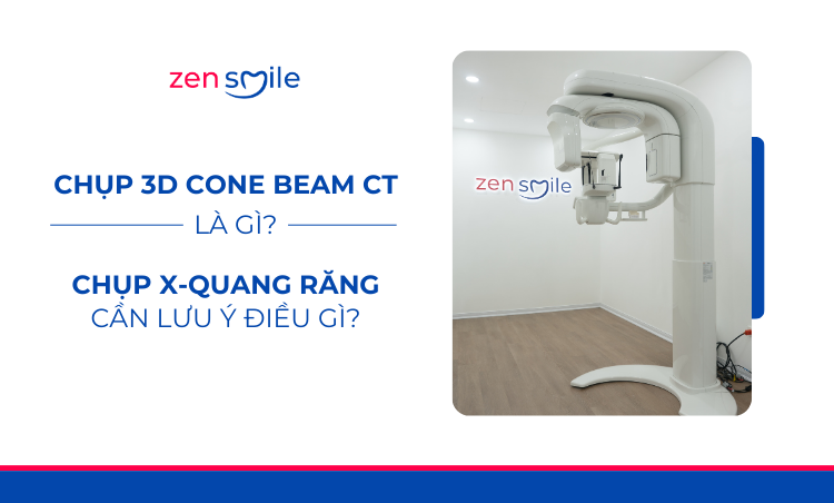 Chụp 3D Cone Beam CT — ảnh 5