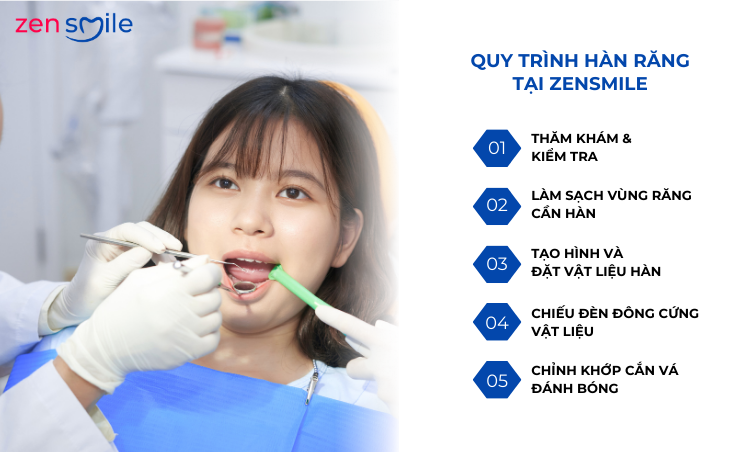 Hàn răng vĩnh viễn (độ 1 – độ 3) — ảnh 5