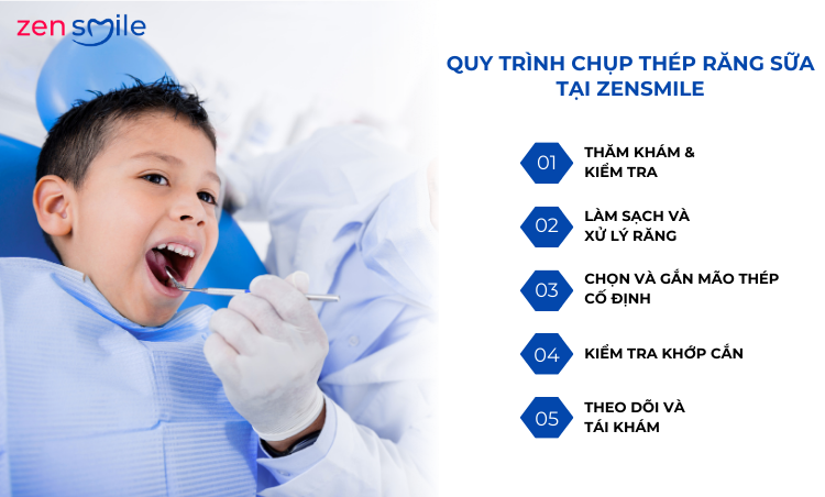 Chụp thép bảo vệ răng sữa trẻ em — ảnh 7