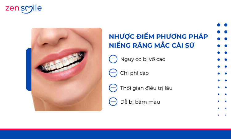 Mắc cài sứ truyền thống — ảnh 7