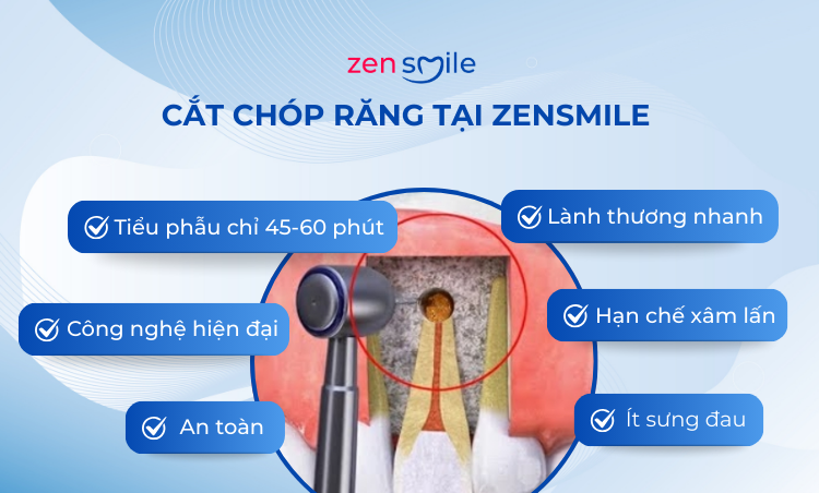 Phẫu thuật cắt chóp răng — ảnh 5