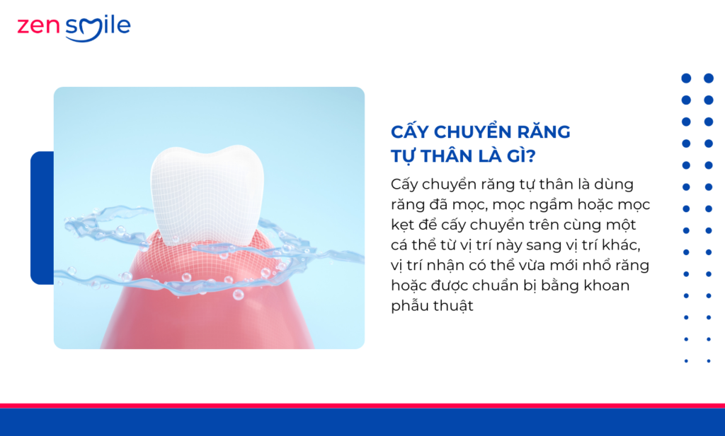 Cấy chuyển răng tự thân — ảnh 7