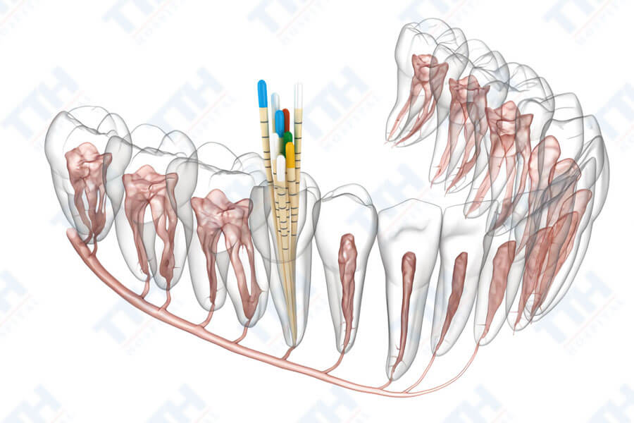 Hàn tuỷ bằng chất hàn sinh học — ảnh 3