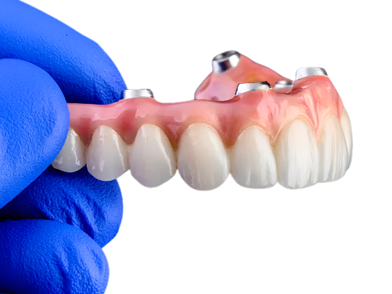 Trồng răng Implant