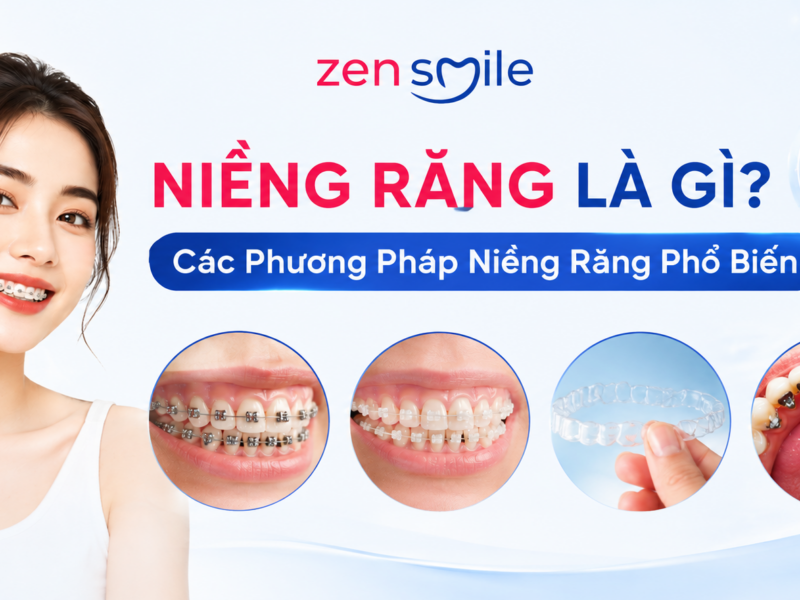 Niềng Răng Là Gì? Các Phương Pháp Niềng Răng Phổ Biến