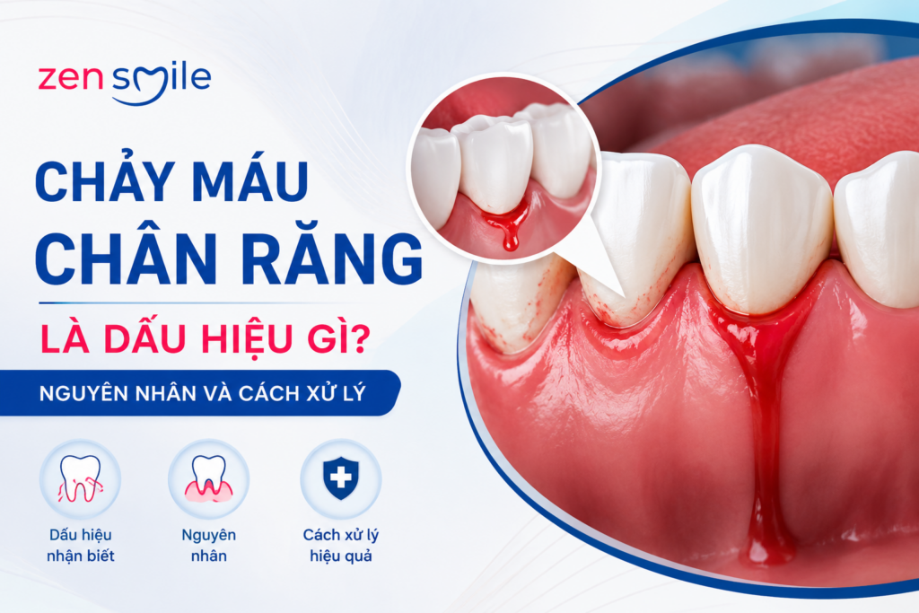 Chảy máu chân răng là dấu hiệu gì? Nguyên nhân và cách xử lý