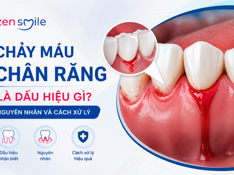 Chảy máu chân răng là dấu hiệu gì? Nguyên nhân và cách xử lý