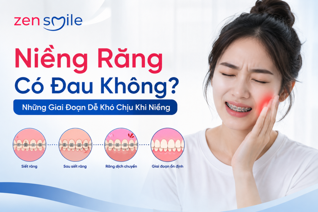 Niềng Răng Có Đau Không? Những Giai Đoạn Dễ Khó Chịu Khi Niềng