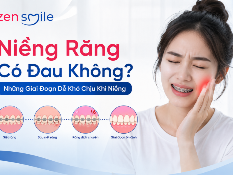 Niềng Răng Có Đau Không? Những Giai Đoạn Dễ Khó Chịu Khi Niềng